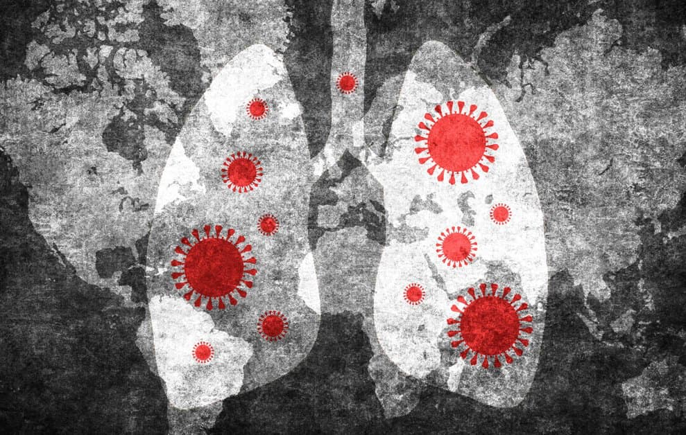 Covid-19 Causes Severe Side Effects in 20 Percent of Victims and is 6 Times More Deadly Than Seasonal Flu