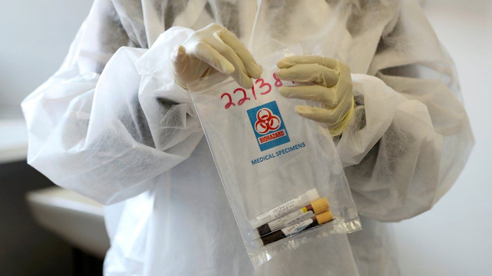 Strain of Covid-19 First Reported in South Africa That Weakens Vaccine Efficacy Detected in U.S.