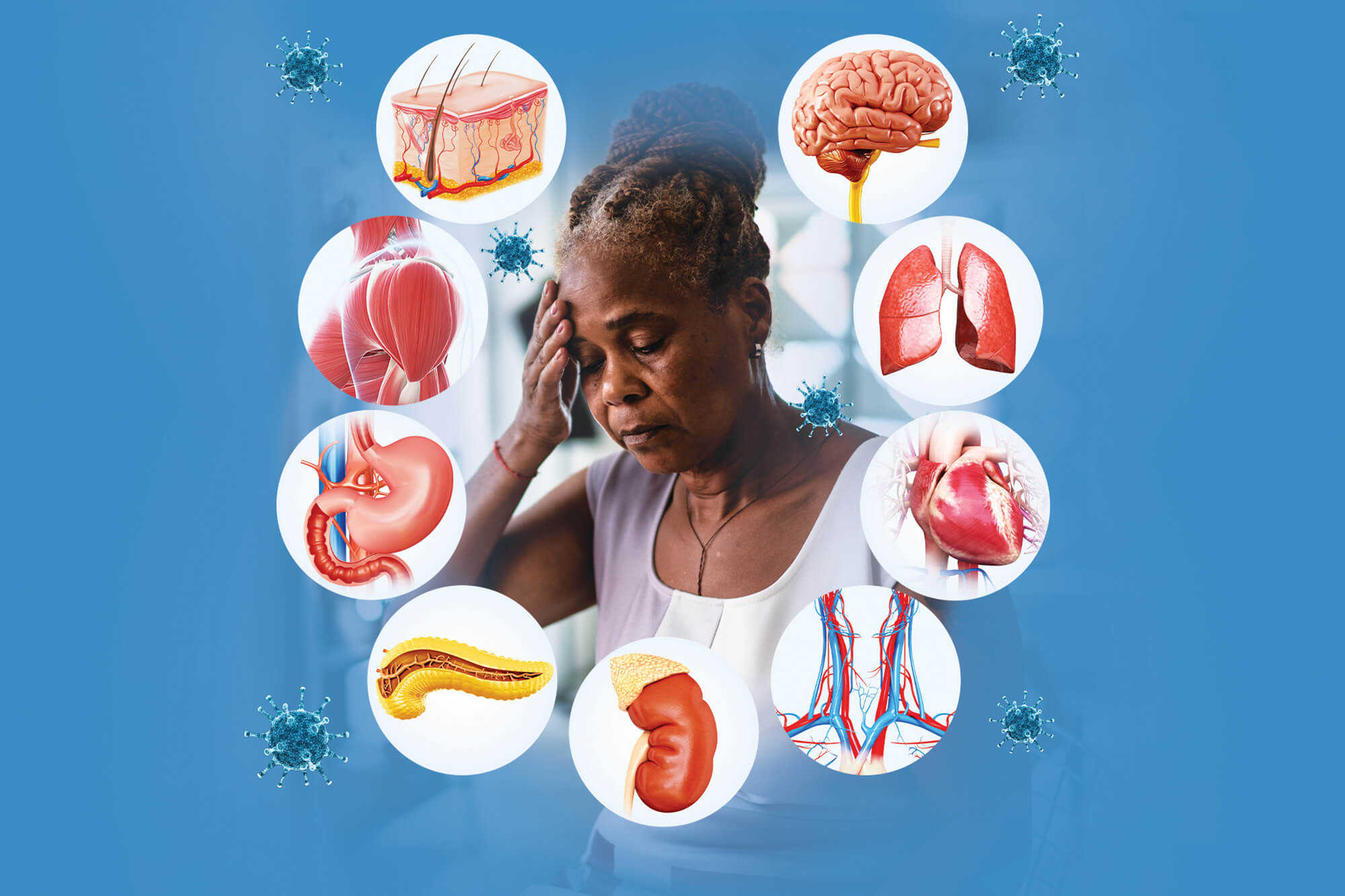 Dangers of Long Covid Remain Even as Pandemic's Intensity Wanes, D.O.H. Medical Director Warns