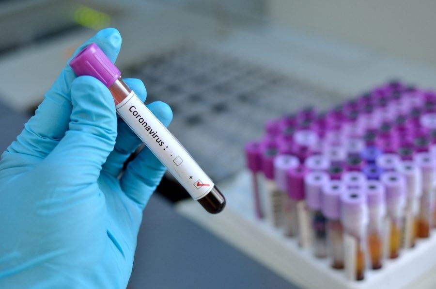 Watch: Governor Bryan Gives Weekend Coronavirus Update