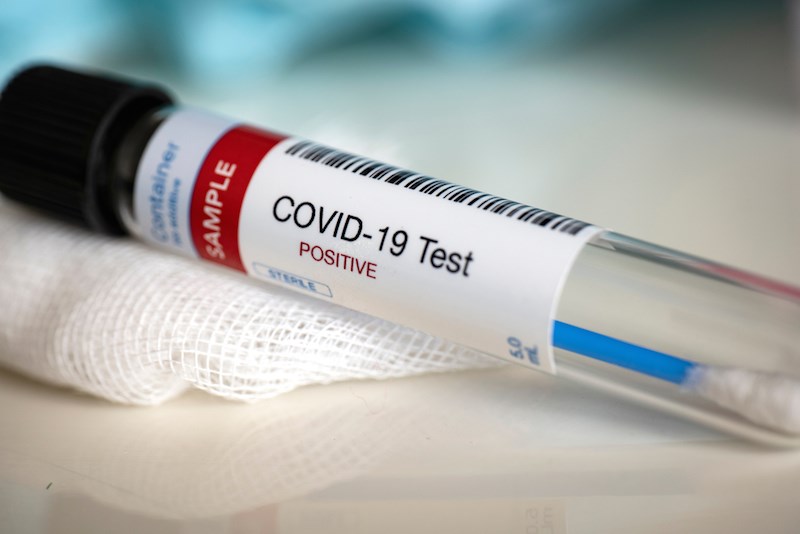 Barbados Has Recorded its First Coronavirus Death