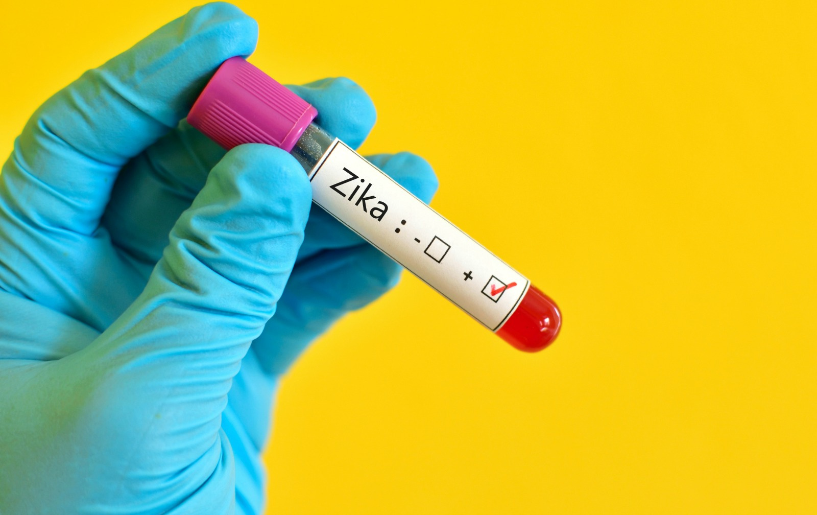 Zika May Be Transmitted By Oral Sex, Scientists Have Found
