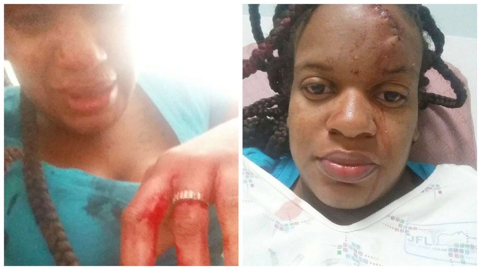 Domestic Violence And Sexual Assault Council Issues Statement Following Brutal Beating Of Female By Then-Boyfriend