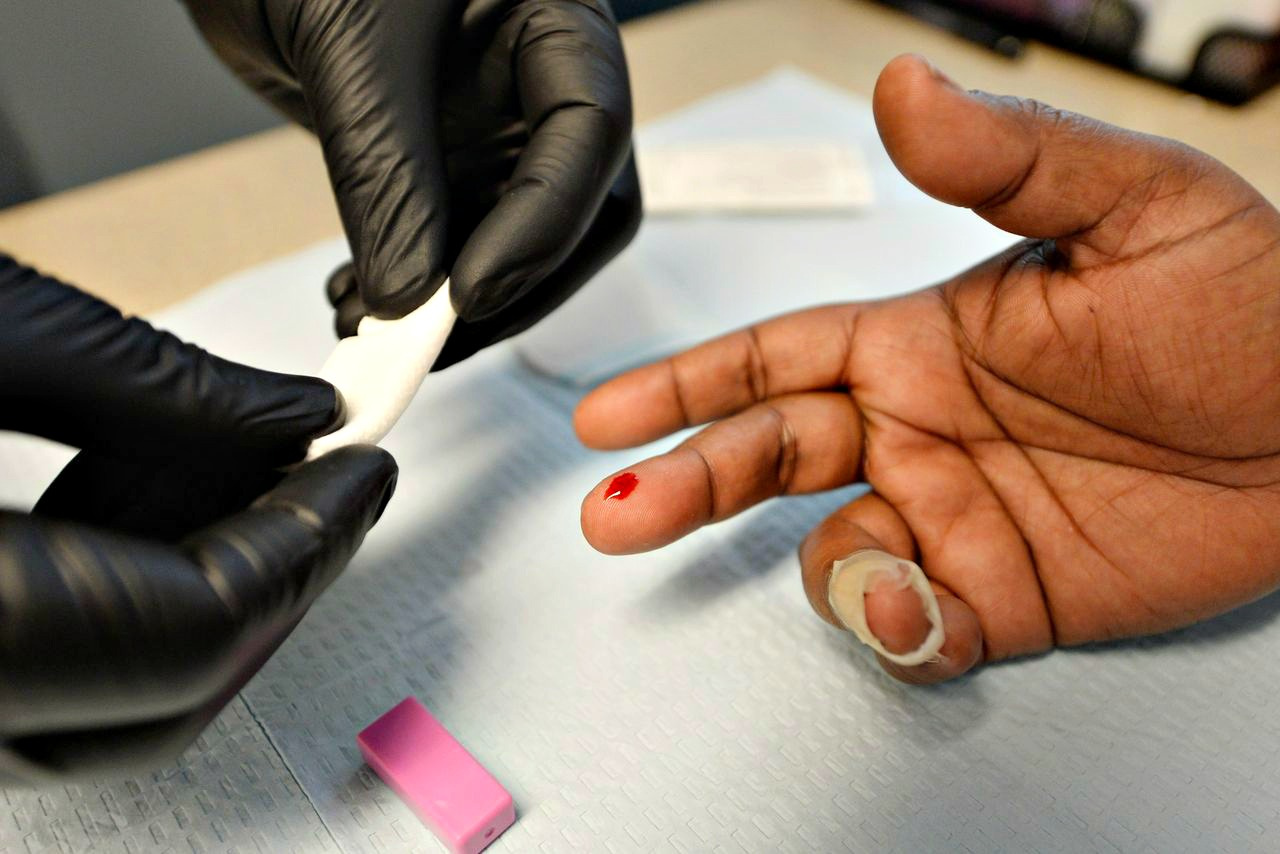 About 600 U.S.V.I. Residents Know They Have H.I.V.; Another 600 Don't, C.D.C. Says