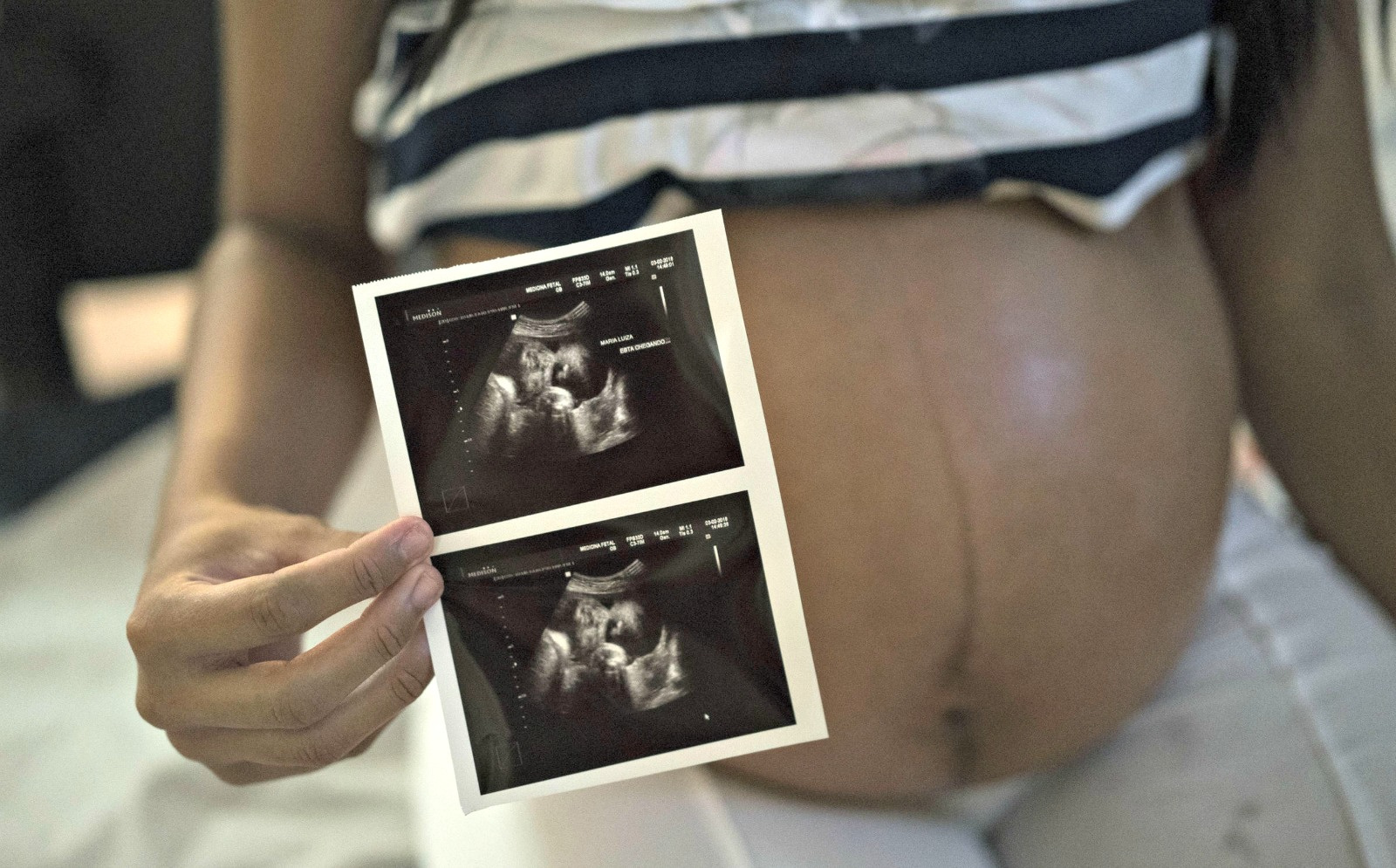 Five Babies Have Been Born To V.I. Mothers Infected With Zika; D.O.H. Confirms 65 New Cases