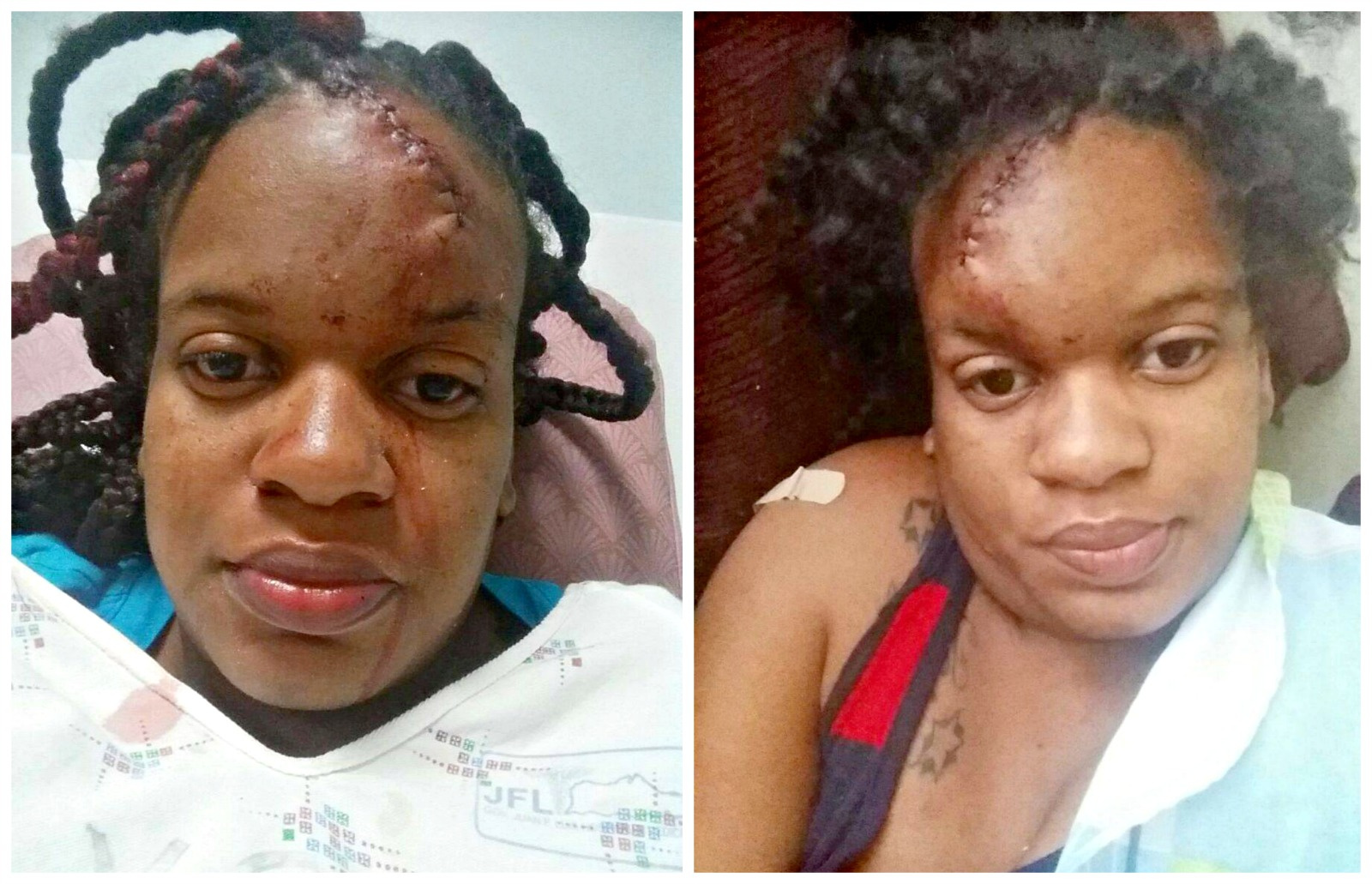 Police Nab Girlfriend Beater; Victim Makes Available Pictures Of Assault Wounds