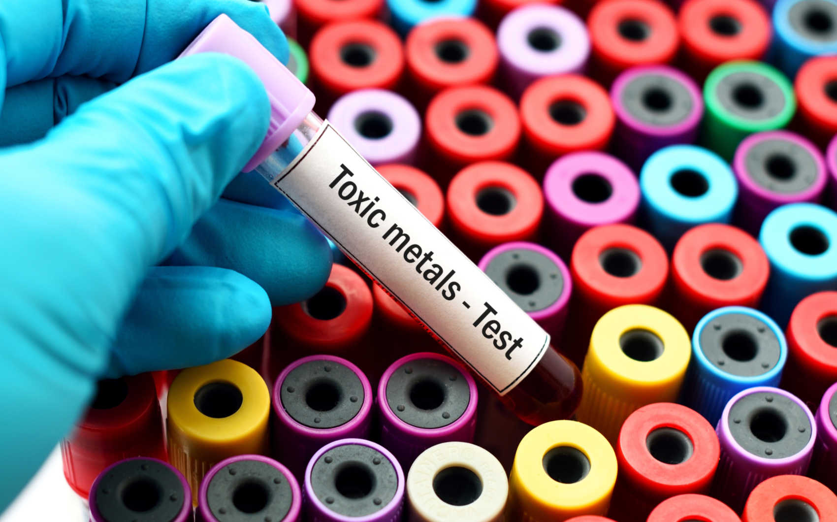 Senators Urge Comprehensive Lead Testing Beyond DOH's Initial 1,000 Child Target